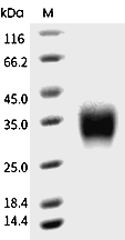 CD32B/Fcgr2b Protein, Mouse, Recombinant (His)