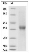 ASGR1 Protein, Human, Recombinant (His)