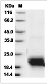 VEGFC Protein, Mouse/Rat, Recombinant (aa 108-223, His)