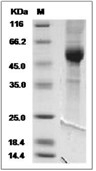 NKG2A/CD159a Protein, Cynomolgus/Rhesus, Recombinant (hFc)