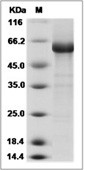 Influenza A H10N8 (A/Jiangxi-Donghu/346/2013) Hemagglutinin/HA0 Protein