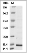 Hepatitis B Virus (HBV)(ayw/France/Tiollais/1979) Capsid protein (His)