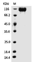 VCAM-1 Protein, Human, Recombinant (hFc)
