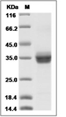 ANGPTL2 Protein, Human, Recombinant (His)