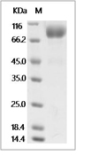 Influenza A H3N2 (A/Singapore/INFIMH-16-0019/2016) Hemagglutinin/HA Protein (His)