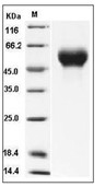 Influenza A H5N1 (A/duck/Laos/3295/2006) Hemagglutinin/HA1 Protein (His)