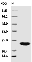 FGF-21 Protein, Human, Recombinant