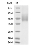 B7-H4 Protein, Cynomolgus, Rhesus, Recombinant (His)