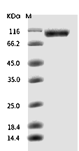 HER2/ERBB2 Protein, Rat, Recombinant (His)