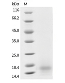 BCMA/TNFRSF17 Protein, Human, Recombinant (His)