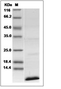 CD81 Protein, Human, Recombinant