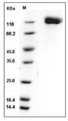 OSMR Protein, Mouse, Recombinant (His)