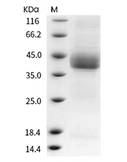 IGFBP-3 Protein, Human, Recombinant (His)