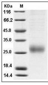 ALK-1 Protein, Human, Recombinant (His)