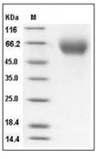 IL-13RA1 Protein, Human, Recombinant (His)