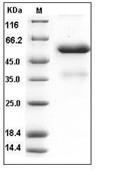 FGF-9 Protein, Human, Recombinant (hFc)