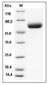 ST6GAL1 Protein, Mouse, Recombinant (His)