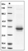 FOLR2 Protein, Human, Recombinant (His)