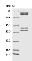 AMPK (G1/B1/A1) Heterotrimer Protein, Human, Recombinant (His & GST)