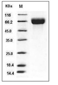 CD98 Protein, Human, Recombinant (His)