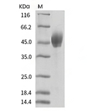 PD-L1 Protein, Mouse, Recombinant (His)