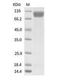 ST2/IL-1 RL1 Protein, Human, Recombinant (hFc)