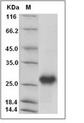 GITR/TNFRSF18 Protein, Human, Recombinant (His)