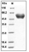 Serpin A1 Protein, Human, Recombinant (His)