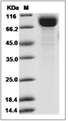 IL-18R alpha Protein, Cynomolgus, Recombinant (hFc)