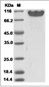 NCAM1 Protein, Human, Recombinant (His)