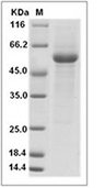 LAG-3 Protein, Human, Recombinant