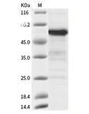 R-Spondin 2/RSPO2 Protein, Human, Recombinant (hFc)