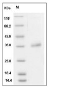 IGFBP-7 Protein, Human, Recombinant (aa 30-282, His)
