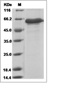 IGFBP-7 Protein, Mouse, Recombinant (aa 1-281, hFc)