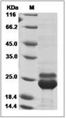 KRAS Protein,Human,Recombinant(G12D & Q61H, His)