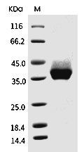 PD-L1 Protein, Cynomolgus/Rhesus, Recombinant (His)
