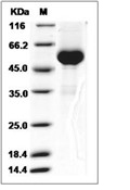 RANKL/TNFSF11/CD254 Protein, Human, Recombinant (mFc)