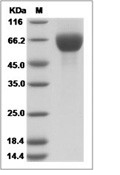 FGFR3 Protein, Human, Recombinant (His)