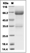 LTBR Protein, Human, Recombinant (hFc)