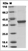 Ebola virus EBOV (subtype Bundibugyo, strain Uganda 2007) VP40/Matrix protein VP40 Protein (His)