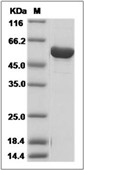 Influenza A H1N1 (A/California/07/2009) Nucleoprotein/NP Protein (His)