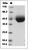 Siglec-3/CD33 Protein, Human, Recombinant (His)