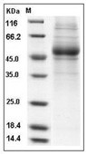 IL-5R alpha/CD125 Protein, Human, Recombinant(aa 1-335, His)