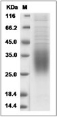 CD47 Protein, Rat, Recombinant (His)