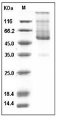 CD70 Protein, Human, Recombinant (hFc)