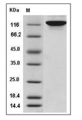 ENPP2 Protein, Human, Recombinant (His)