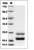 GM-CSF/CSF2 Protein, Rat, Recombinant (His)