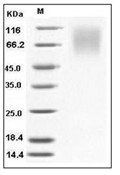 LAMP1 Protein, Human, Recombinant (His)