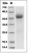 IL-1R2 Protein, Human, Recombinant