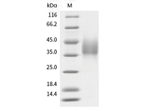 CD47 Protein, Human, Recombinant (aa 1-139, His)